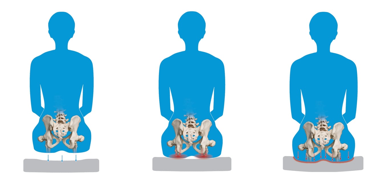 What is an immersion style wheelchair cushion?